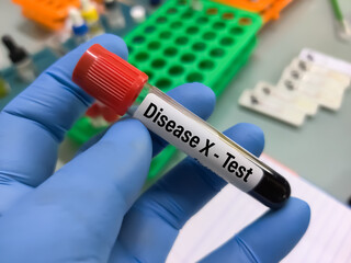 Obraz premium Blood sample for Disease X test. Disease X represents the knowledge that a serious international epidemic could be caused by a pathogen currently unknown to cause human disease