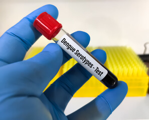 Blood sample for Dengue Serotypes (Denv 1, 2, 3 and 4) test. To diagnosis dengue fever