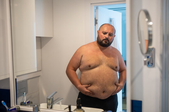 Fat obese guy touching stomach in front of mirror. Young bearded bald man with excess overweight looks at mirror dissatisfied with fatness extra weight, concerned about appearance, figure.