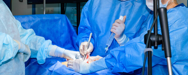 A team of doctors and nurses in blue sterile gowns performs a surgical operation. Surgeons use surgical instruments during surgery.