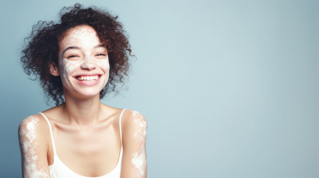 shot of young adult african woman with vitiligo skin. Diversity and people concept