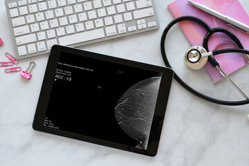 Diagnostic Mammogram scan on tablet screen of doctor or radiologist desk - pink breast cancer awareness month October - Powered by Adobe