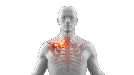 Human x-ray skeleton with broken clavicle - obrazy, fototapety, plakaty