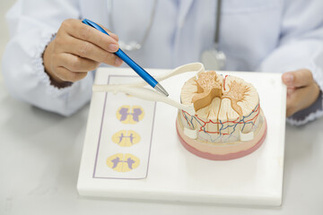Orthopedic surgeon showing anatomy model human spinal cord on white background.Neurosurgeon using...