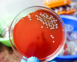 Bacterial colony on petri dish, microbiology.