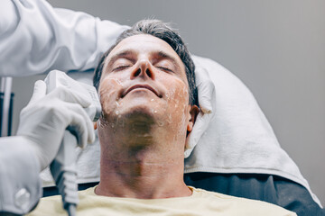Skin doctor using HIFU resurfacing facial skincare treatment technology with adult male to reduce...