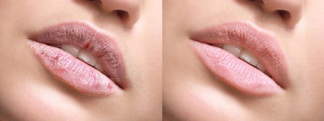Young woman with beautiful lips, closeup