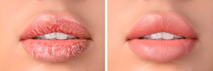 Young woman with beautiful lips, closeup