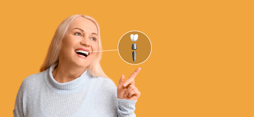 Smiling mature woman with implanted tooth on yellow background
