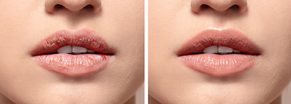 Beautiful young woman with natural makeup on color background, closeup