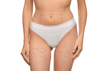Slim woman with markings on body before cosmetic surgery operation on white background, closeup