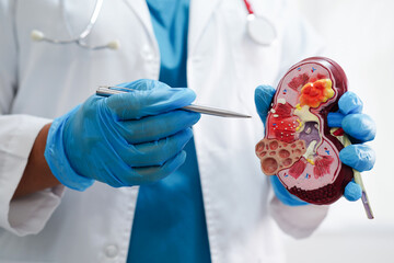 Chronic kidney disease, doctor holding model for treatment urinary system, urology, Estimated...