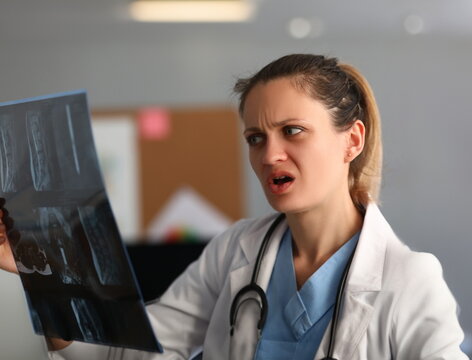 Female doctor looks in amazement and shock at x-ray of spine. X-ray images of lungs concept