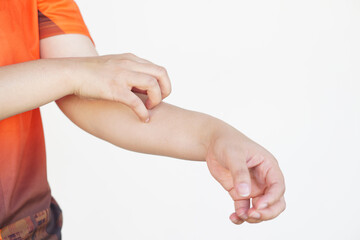 Close up woman hand is scratching her itchy arm. Concept, health problem. Itchy from allergy, rashes, dry skin,  insects bite, fungus or dermatitis.  