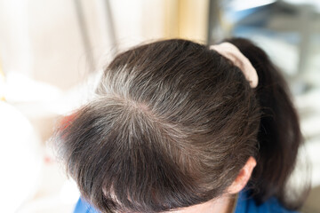 Head of an elderly woman with gray hair that grew after dyeing