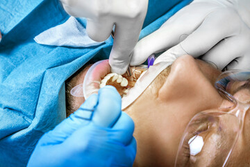 Close-up shot of attentive doctors performing surgical operation installing dental implants into patient's mouth in modern dental clinic. Dental instruments. Stomatology clinic. Dental surgery.