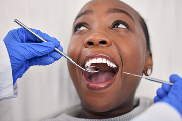 Dentist hands, patient mouth and tools, check teeth for dental health and medical treatment. Oral...