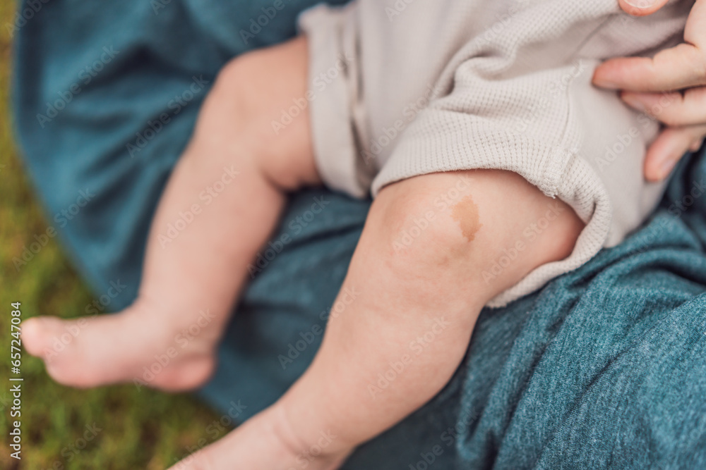 Wall mural tiny baby feet, adorned with a charming birthmark, explore the world outdoors, symbolizing innocence