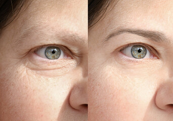 close up part face mature woman 55 years old, human eye, lower, upper eyelid, deep facial wrinkles...