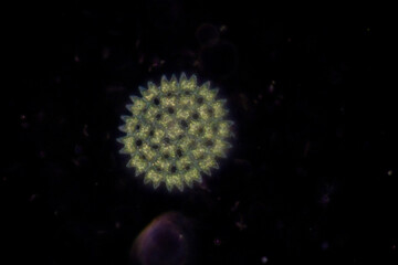 Study of Protozoa and Algae under the microscope for education.