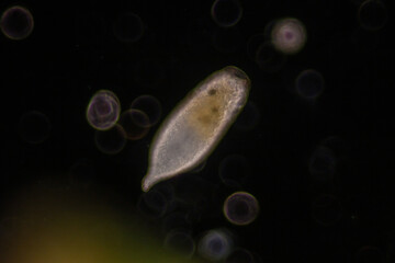 Study of Protozoa and Algae under the microscope for education.
