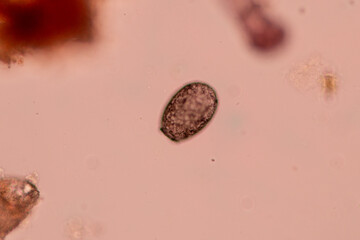 Study of Protozoa and Algae under the microscope for education. - obrazy, fototapety, plakaty