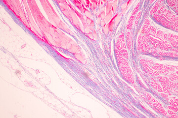 Histological Rectum human, Gall bladder human and Urethra Human under the microscope for education.