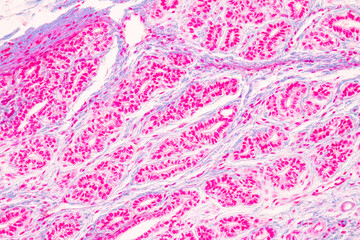 Histological Rectum human, Gall bladder human and Urethra Human under the microscope for education.