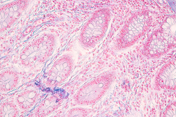 Histological Rectum human, Gall bladder human and Urethra Human under the microscope for education.