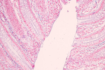 Histological Rectum human, Gall bladder human and Urethra Human under the microscope for education.