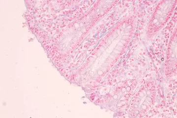 Foto op Canvas Histological Rectum human, Gall bladder human and Urethra Human under the microscope for education. © sinhyu
