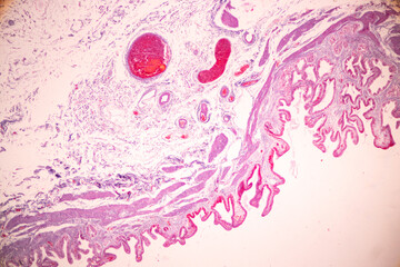 Histological Rectum human, Gall bladder human and Urethra Human under the microscope for education.