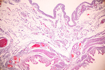 Histological Rectum human, Gall bladder human and Urethra Human under the microscope for education.