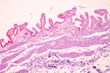 Histological Rectum human, Gall bladder human and Urethra Human under the microscope for education.