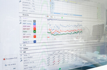 Medical monitor displays vital signs with graphs and numbers, heart rate, blood pressure, temperature, conveying health data, technology, healthcare, and patient monitoring concepts