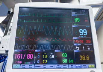 Medical monitor displays vital signs with graphs and numbers, heart rate, blood pressure, temperature, conveying health data, technology, healthcare, and patient monitoring concepts