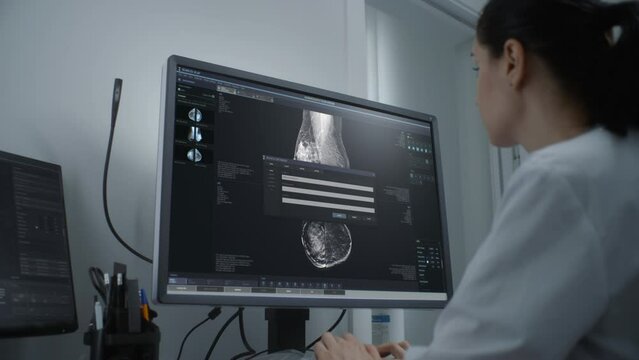 Professional female doctor examines results of mammography screening procedure using computer. Mammogram scans of breast tissues displayed on PC screen. Breast cancer prevention. Hospital or clinic.