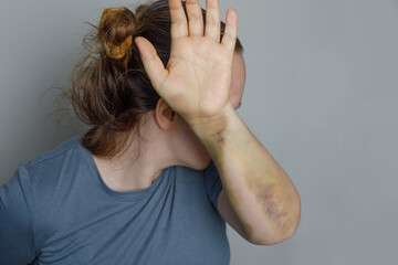 Stop abusing violence. Violence and abuse concept