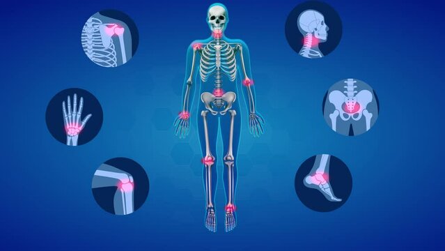 Joint Inflammation in Human Body and Arthritis Therapy Illustrative animation. The Solution Of Bones Pain or Anti-inflammatory Medication and Osteoarthritis Treatment I'm All Human Skeleton. 