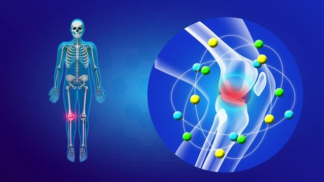 Anti-inflammatory Medication of Joint Inflammation Illustrative animation Over Knee Bones of human Skeleton. Inflamed Knew and Treatment. Arthritis Medical Reliefer  and and Pain solution 