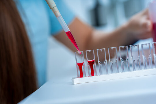X-ray Absorption Spectroscopy: Place the sample in the cuvette and mea