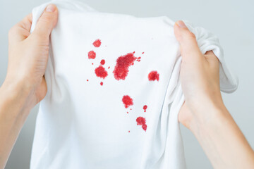 Female hands showing dirty blood stain on white cloth. Spoiled clothes. Dirty stain for cleaning concept - obrazy, fototapety, plakaty