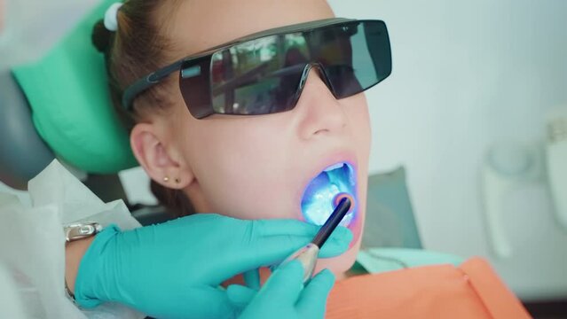 Dentist installs photopolymer seal in dentistry to patient teen girl.