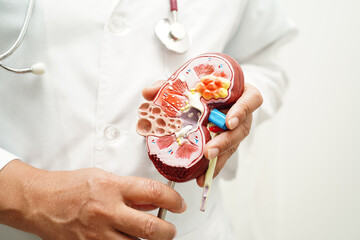 Chronic kidney disease, doctor holding model for treatment urinary system, urology, Estimated...