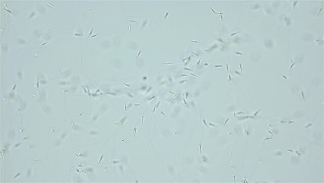 Sperm (spermotozoa) of sea snail Testudinalia testudinalis under microscope, family Lottiidae. Common name is common tortoise limpet. White sea