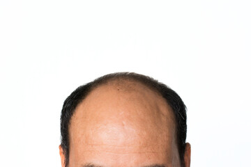 Bald man isolated on white background.
