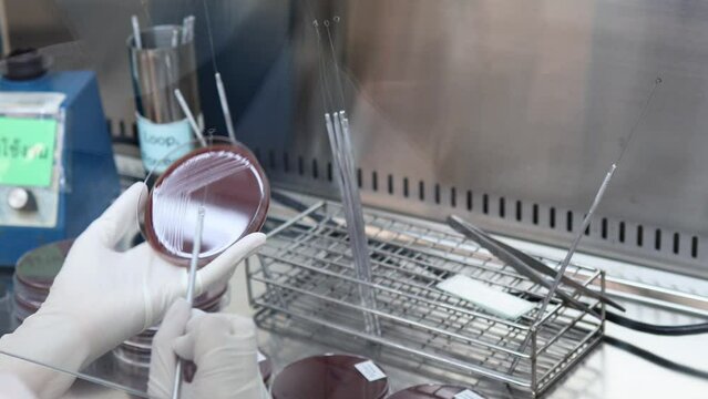 A research laboratory Streak colony on culture medium test for antibiotic resistance, Drug resistant gonorrhea, 4K footage.