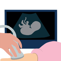 Pregnant ultrasound examination. Monitoring baby health with ultrasonic imaging device. Prenatal care screening. Flat vector cartoon illustration isolated on white background