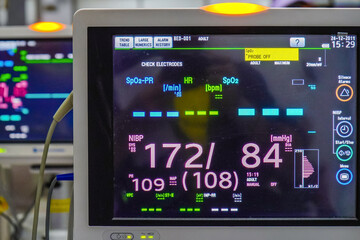 Modern vital sign monitor on patient background at ward in the hospital.