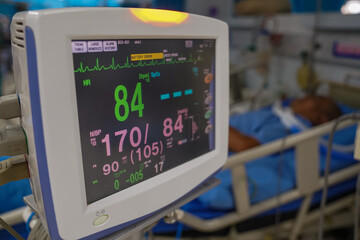 Modern vital sign monitor on patient background at ward in the hospital.